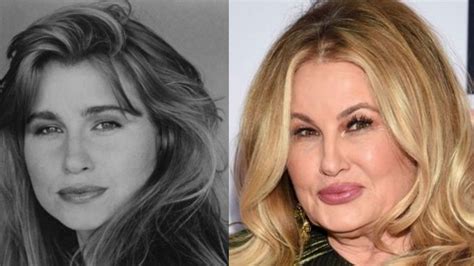 jennifer coolidge before surgery|Jennifer Coolidges plastic surgery and stunning transformation